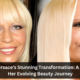 Donatella Versace’s Stunning Transformation: A Look Back at Her Evolving Beauty Journey