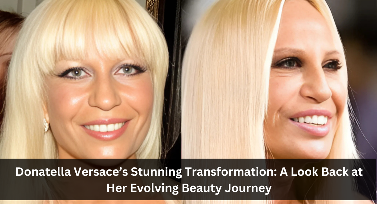 Donatella Versace’s Stunning Transformation: A Look Back at Her Evolving Beauty Journey